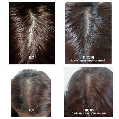 Шампунь проти випадіння волосся Dr.FORHAIR Folligen Shampoo, 500мл Купити оптом в Україні