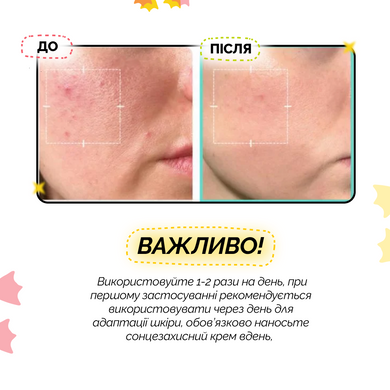 Успокаивающая сыворотка с азелаиновой кислотой 16% Medicube Azelaic Acid 16 BB Calming Serum, 30 мл Купить  оптом в Украине