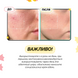 Фото Успокаивающая сыворотка с азелаиновой кислотой 16% Medicube Azelaic Acid 16 BB Calming Serum, 30 мл 8800289479083 5