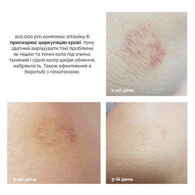 Ампула с липосомальной формулой витамина К Dr.Ceuracle PLC Vita K Liposome Oil Ampoule, 50 мл Купить  оптом в Украине